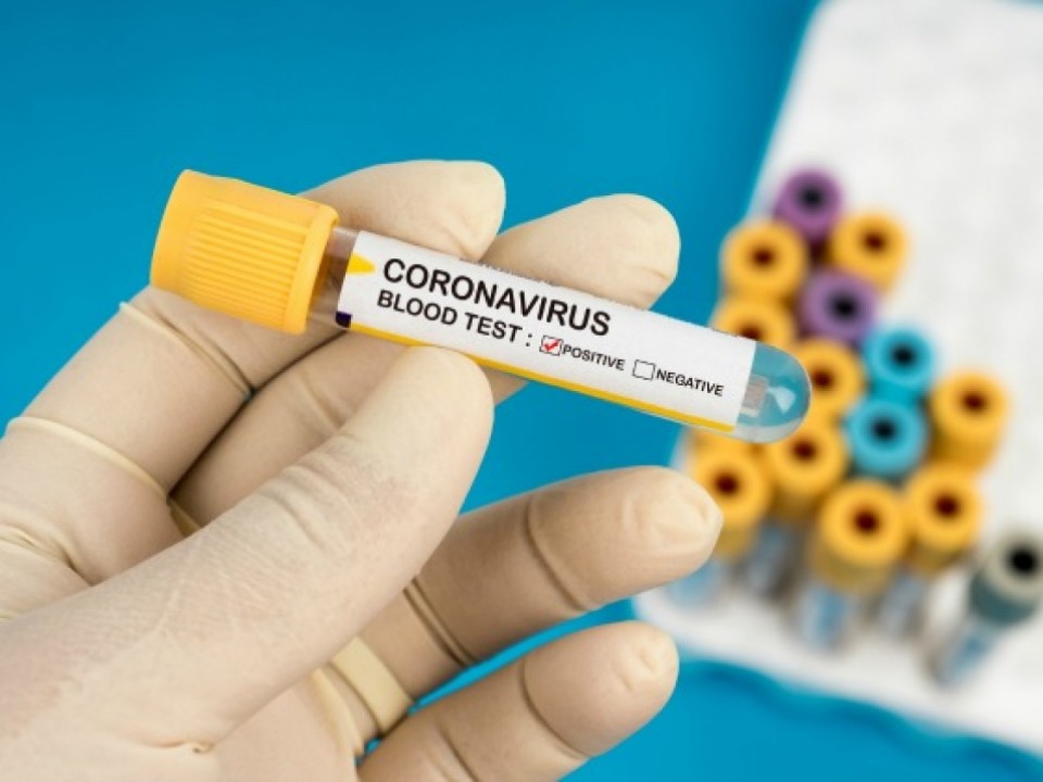 Magánellátásban is elérhető lesz a koronavírus kimutatását szolgáló teszt
