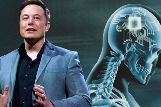 Elon Musk agyba ültethető chipje az emlékeinket is lementheti