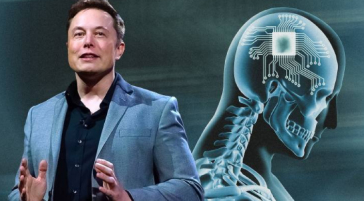 Elon Musk agyba ültethető chipje az emlékeinket is lementheti